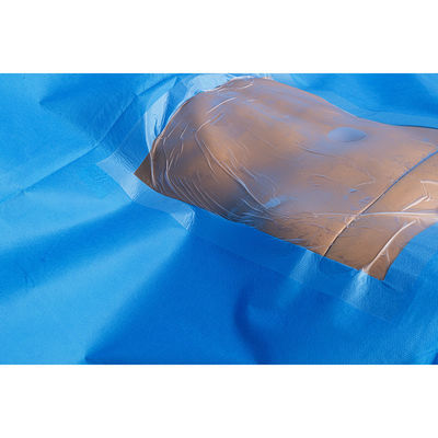 Sản phẩm phẫu thuật vô trùng C-section Pack Set C-section Surgical Pack C-section C-section Drape